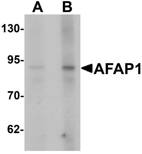 WB - AFAP1 Antibody ASC11397